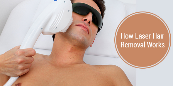 How Does Laser Hair Removal Work? | Centre for Dermatology