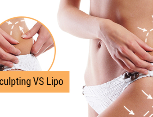 What’s the Difference Between CoolSculpting and Lipo?