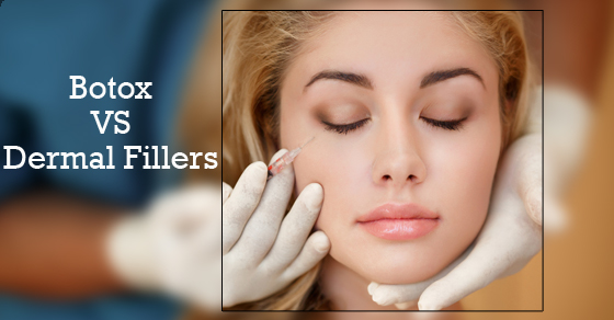 Botox VS Dermal Fillers