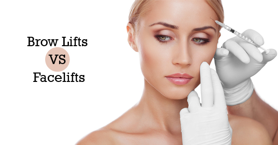 Brow Lifts VS Facelifts