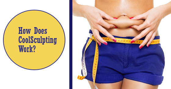 fat coolsculpting eliminated removal