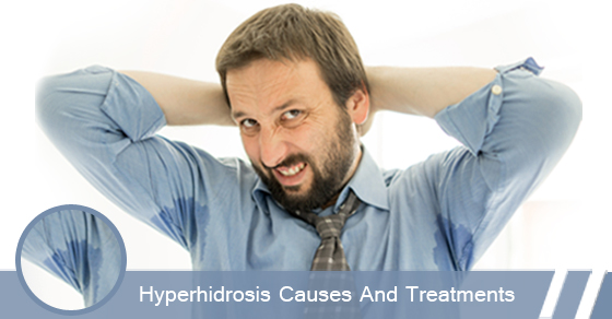 Hyperhidrosis