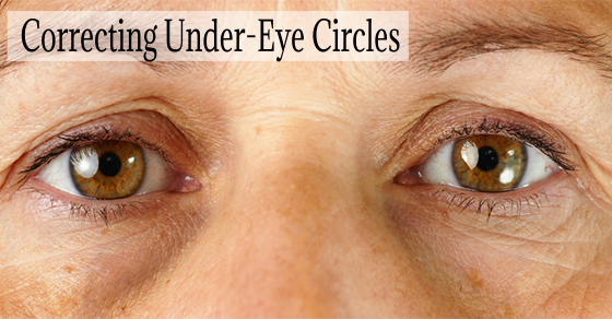 Under-Eye Circles