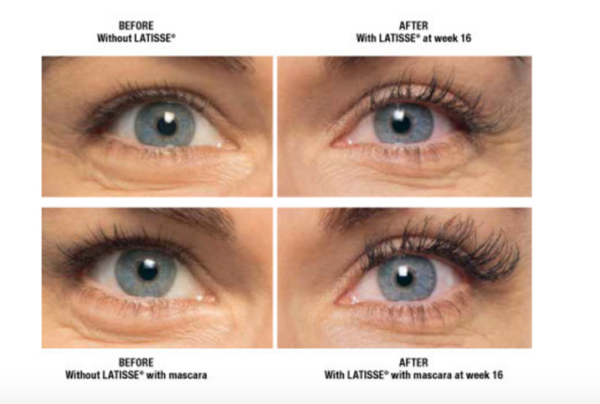 Do you wish you had thicker, longer, and darker lashes