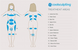 coolsculpting